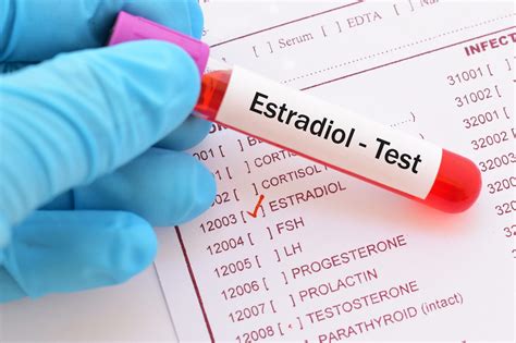 estradiol exame